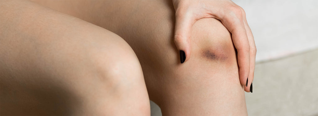 What is the condition of dark knees?