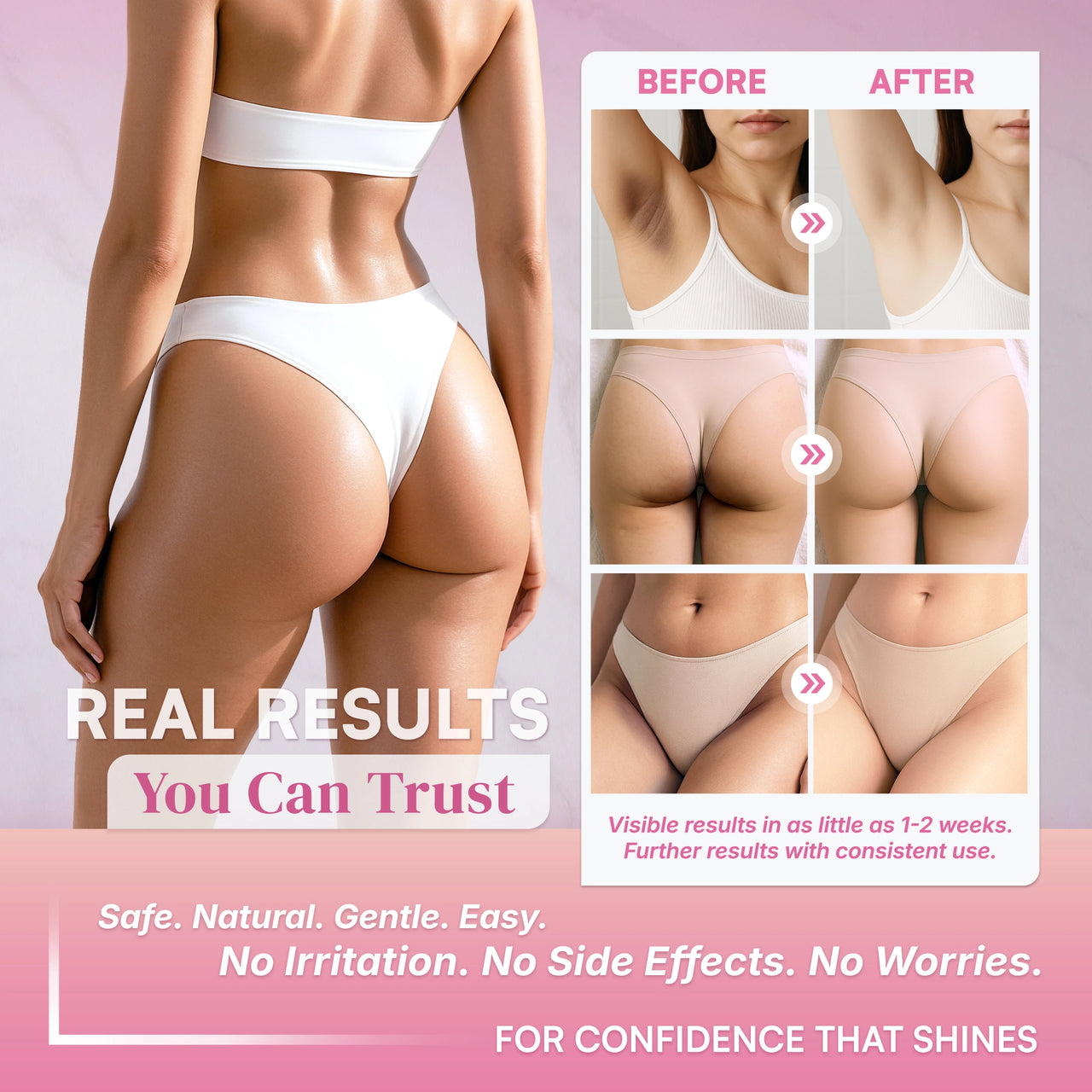 SB Skin Brightening Gel for Sensitive Areas