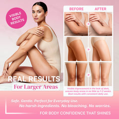 SB Skin Brightening Body Milk (for Knees, Elbows & Inner Thighs)