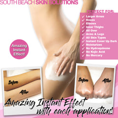 SB Skin Brightening Body Milk for Knees, Elbows & Inner Thighs